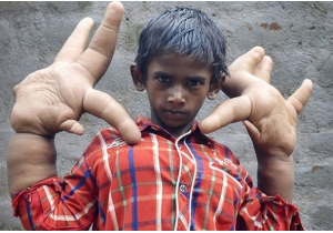 ӡСкºĬ¡ķ(Mohamm...